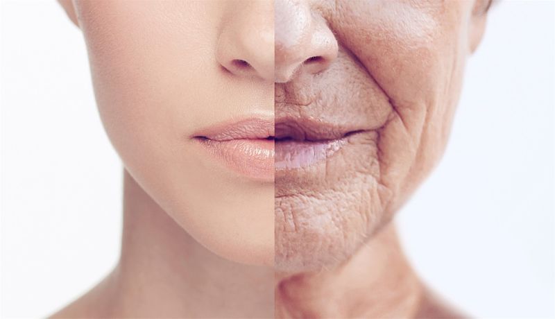 Làn da có nhiều nếp nhăn và nám do lão hóa da