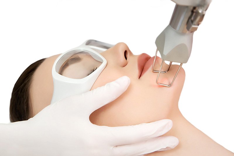Công nghệ laser bóc tách mang lại hiệu quả cao hơn